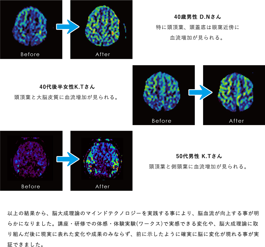 脳大成理論のマインドテクノロジーを実践する事により、MRI検査の結果から明らかになりました